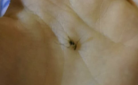 打蚊子日记锦集5篇